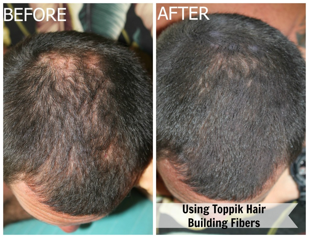 Review Toppik Hair Building Fibers For Balding And Thinning Hair
