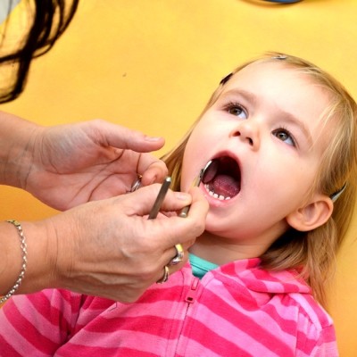 Foods that Surprisingly May Cause Tooth Decay in Children